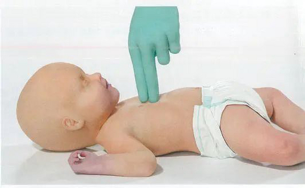 心肺复苏步骤 CPR操作步骤