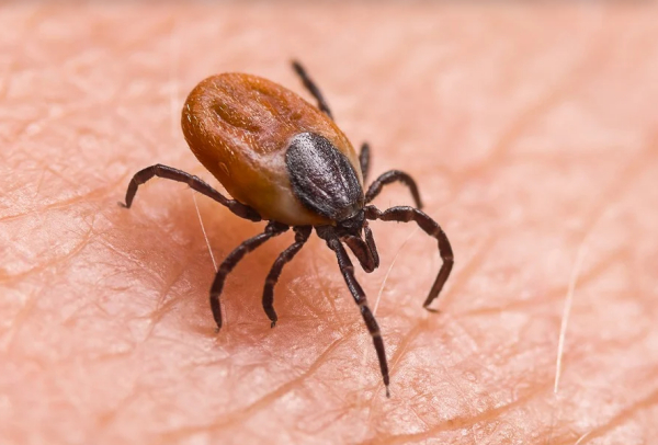 蜱虫叮咬怎么办？能不能抓捏蜱虫？