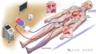 2023年美国心脏协会对急诊复苏医学的最新观点（三）