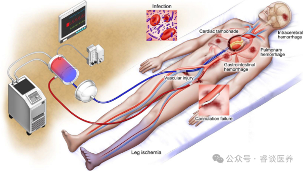 2023年美国心脏协会对急诊复苏医学的最新观点（三）